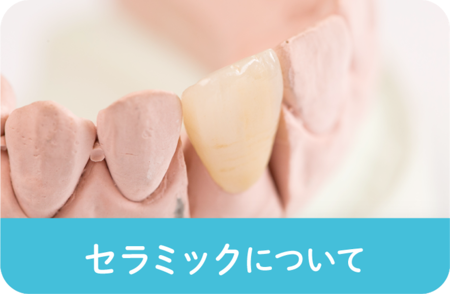 セラミックバナー