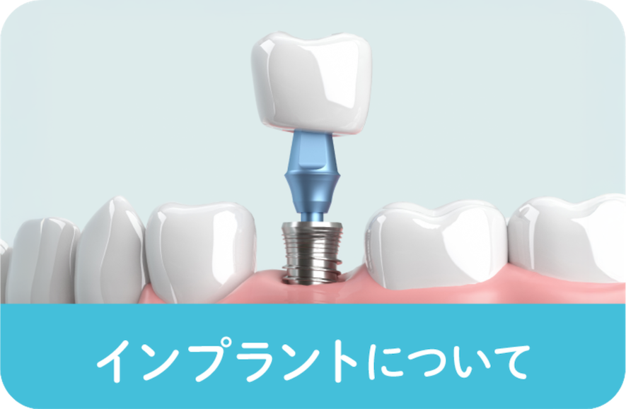 インプラントバナー