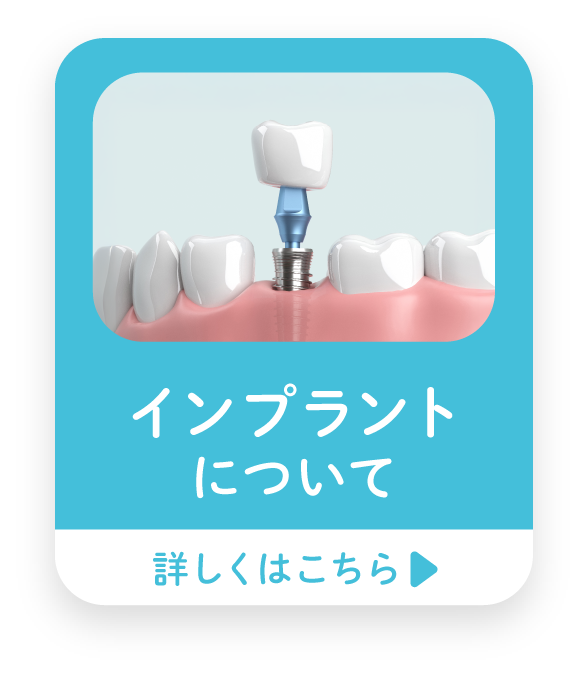 インプラントバナー