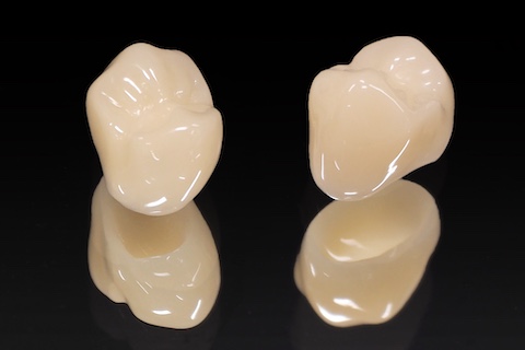 ハイブリッドレジン冠