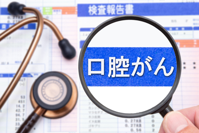 舌がん以外にもある！お口の中にできるがんの種類と特徴について詳しく解説