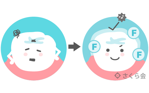 フッ素塗布の説明画像