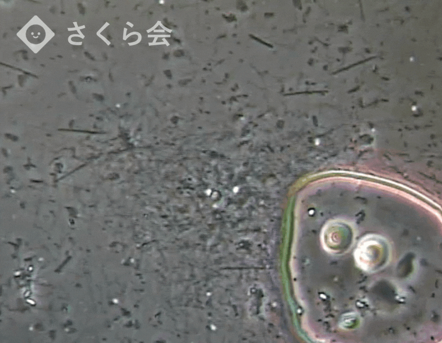 顕微鏡で見た治療前の写真