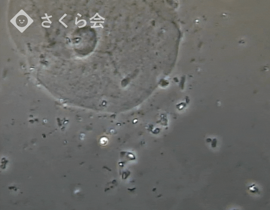 顕微鏡で見た治療後の写真