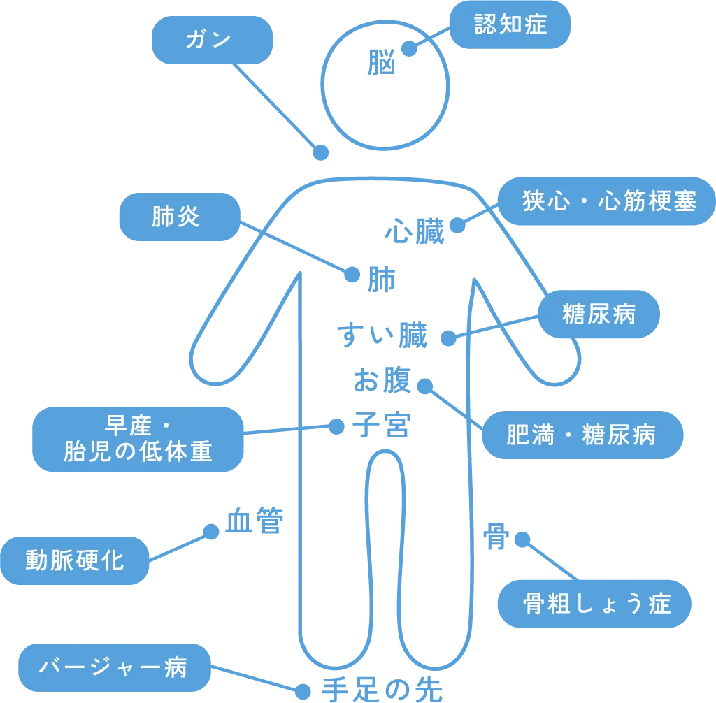 歯周病が全身の健康に与える影響図 - 心疾患・糖尿病・脳卒中など