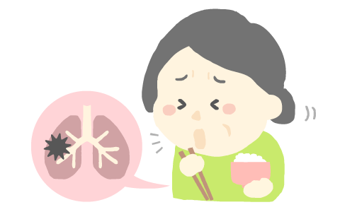 誤嚥性肺炎のリスク